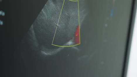 close up of medical monitor screen displaying real time movement of internal organs and tissue during diagnostic scan procedure in clinical lab with high resolution imaging system for evaluation