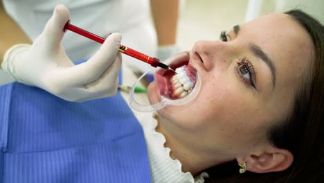 Zahnarzt-Und-Patient-Während-Des-Bleaching-Verfahrens