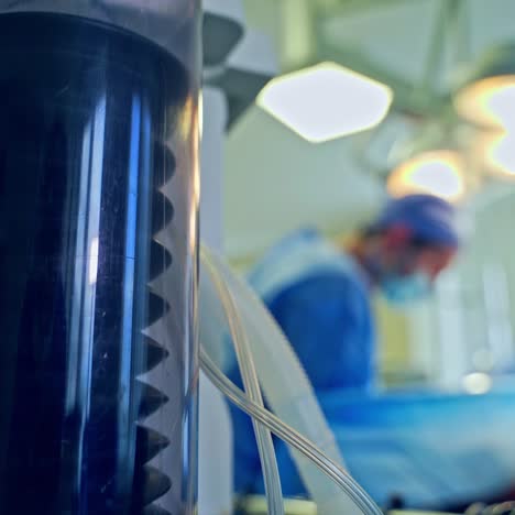 mechanical ventilation system