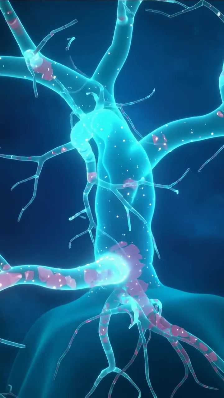 Vertical video: Camera shifting, neuron moving specks in blue, showing magenta nodules and swelling