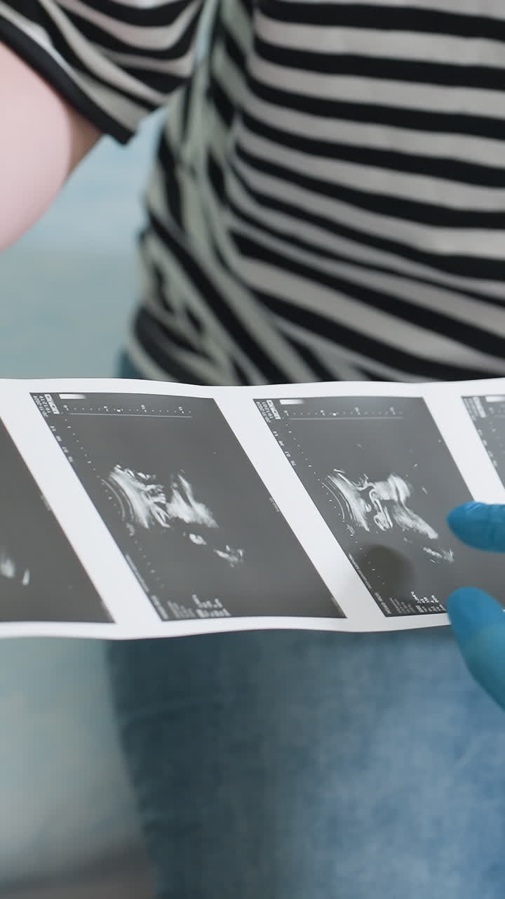 closeup white parent holding ultrasound strip casual striped shirt and jeans, gloved hand points at sonogram frames, emotional intimate moment, keepsake viewing, soft homelike atmosphere, bonding