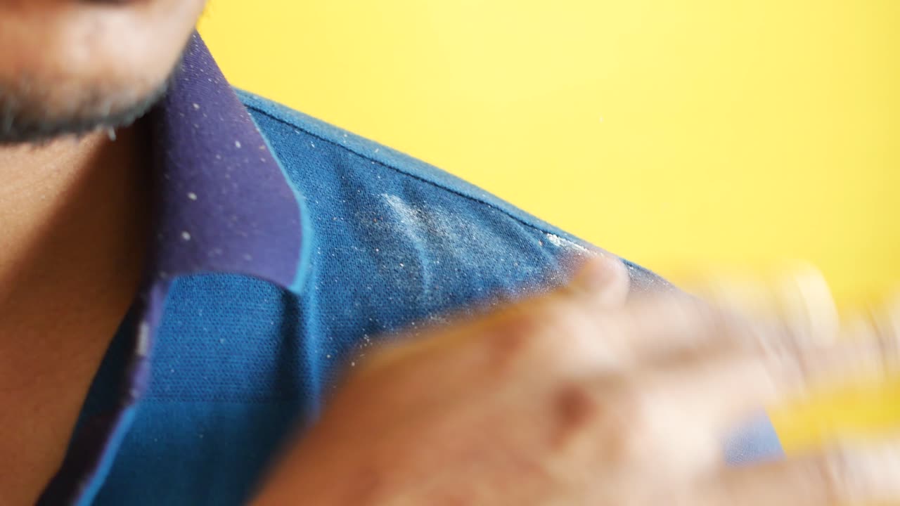 Men with dandruff on his shirt