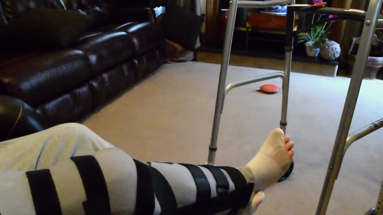 완전한 무 ⁇  교체 후 며칠 후 워커로 전환