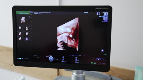 3d ultrasound fetal scan