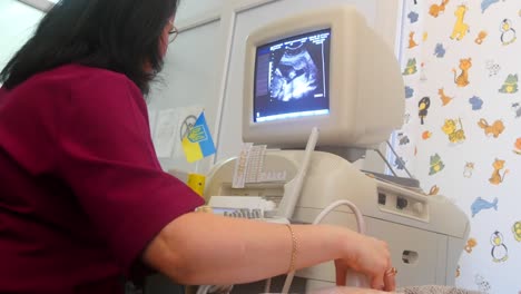 ultrasound scan of a pregnant woman