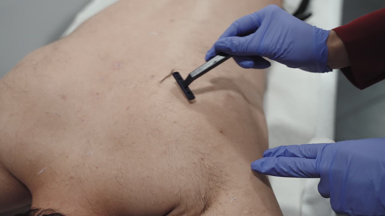 подготовка к удалению волос лазером, бритье волос с помощью бритвы