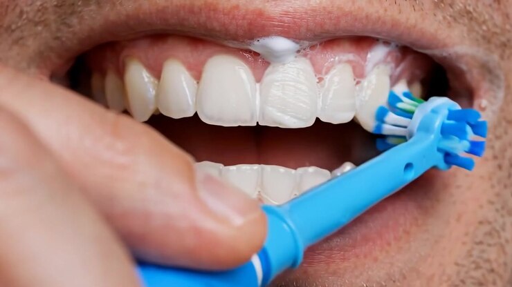 Primo piano di uno spazzolino elettrico blu con schiuma di dentifricio che spazzola i denti bianchi di un uomo
