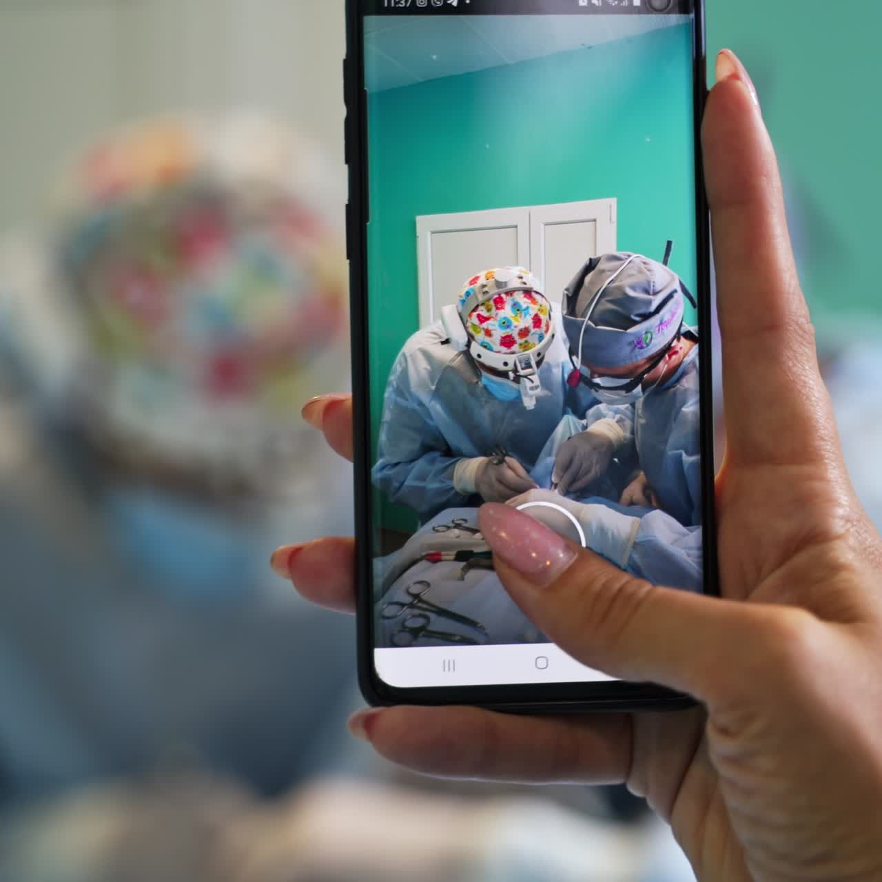 Shooting surgical operation process on the smartphone. Taking video of surgery on the phone close up. Blurred backdrop