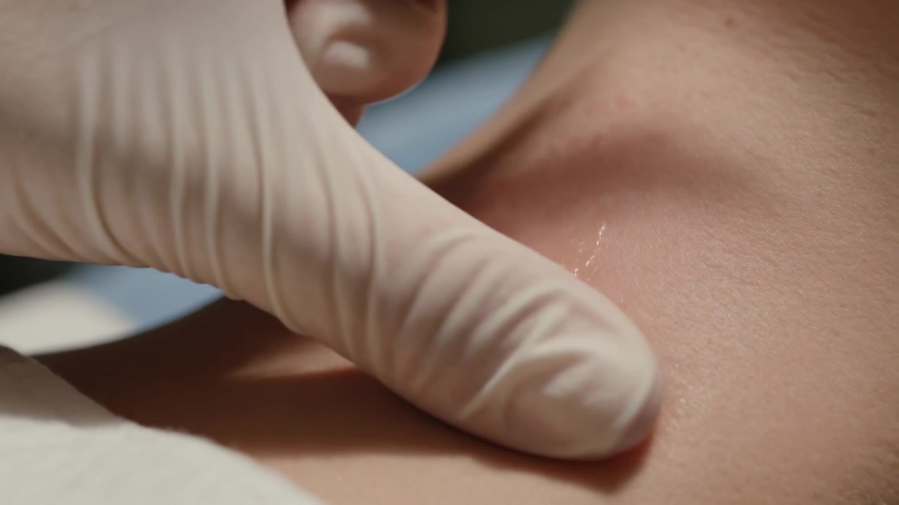 Sprøjte nærmer sig hud, handskebærende kliniker placerer væske, trækker nål ud, gnider nederste del af nakken på klinik