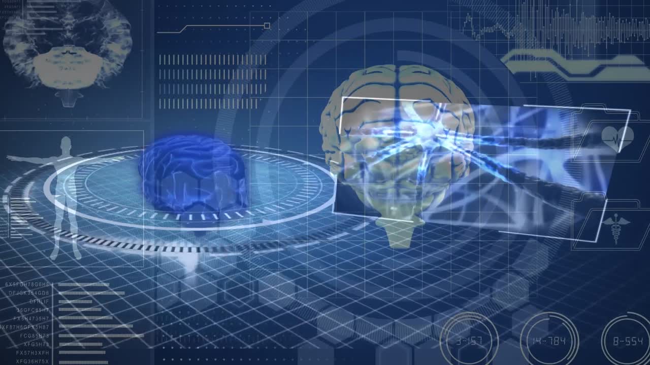 Animation of digital screens over scope scanning and digital brain