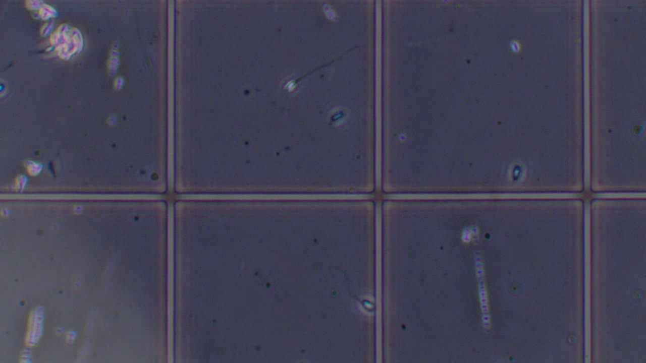 Human sperm cells moving in a grid under a microscope, revealing reproductive health and fertility studies in a laboratory
