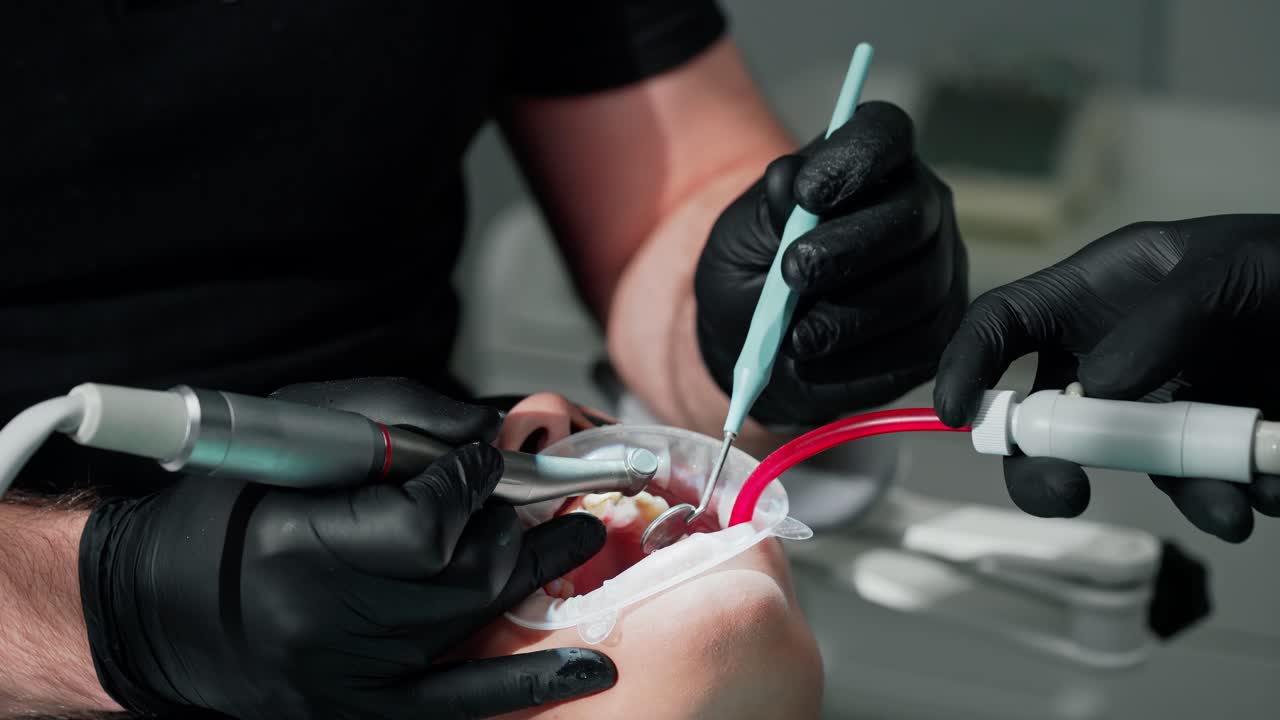 Female patient's face with open mouth. Hands of dentist in gloves with medical tools treating client's teeth. Patient receiving tooth treatment in dental office. Close-up.