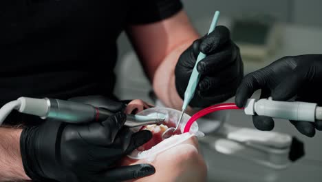 female patient's face with open mouth. hands of dentist in gloves with medical tools treating client's teeth. patient receiving tooth treatment in dental office. close-up.