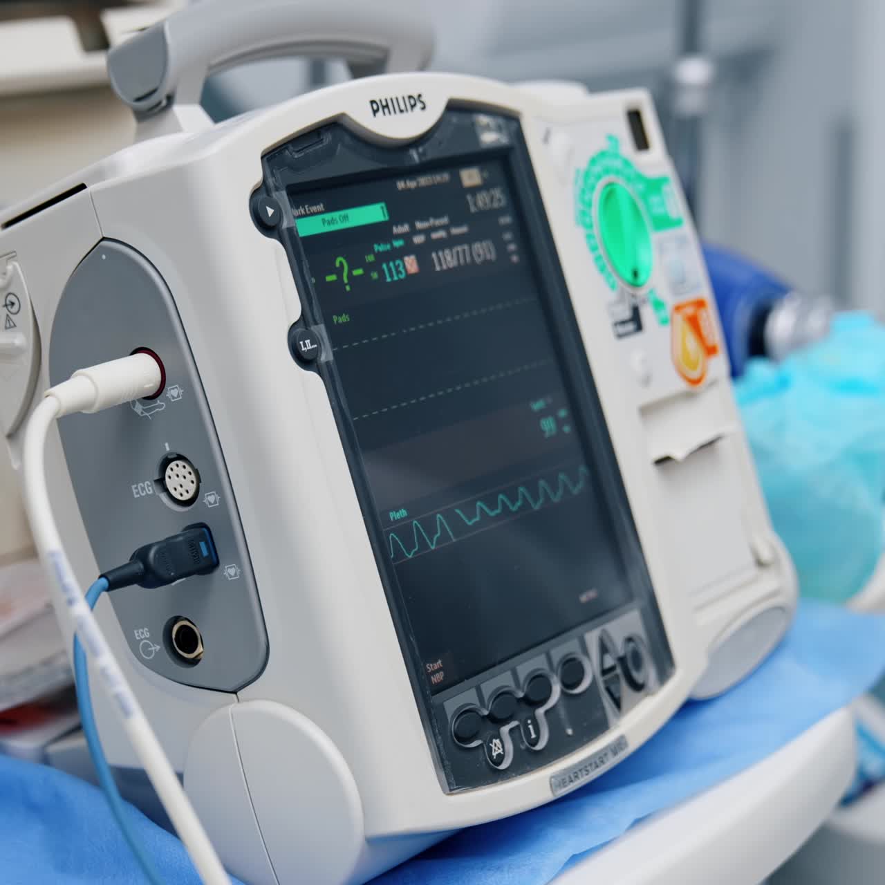 Advanced portable equipment working in the hospital ward. Apparatus showing the life signs of a patient under surgery