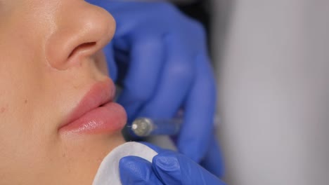 lip filler procedure