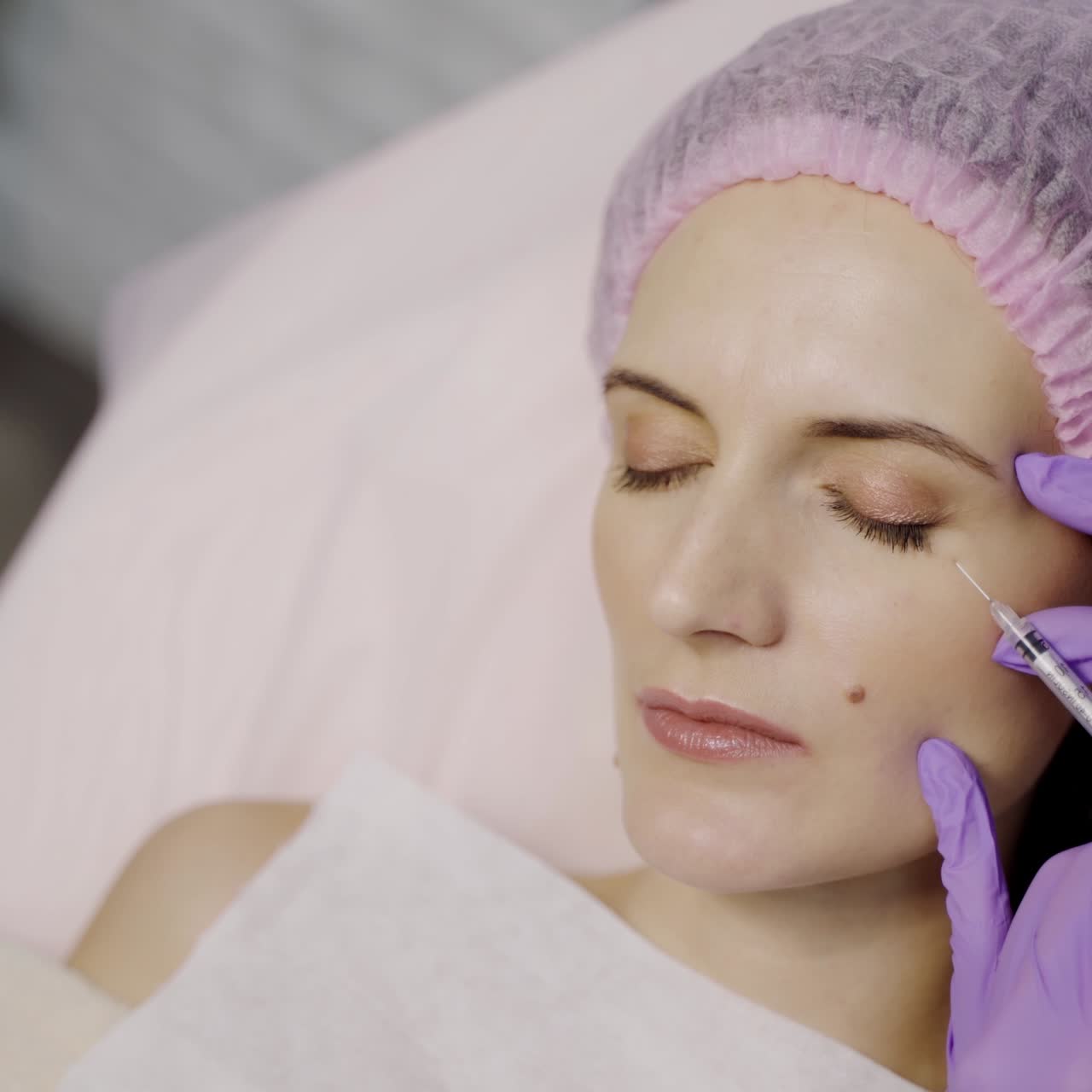 A beautiful woman is lying on the couch in the office of a beautician on the Botox procedure in the eye area. Beauty injections. Close-up.