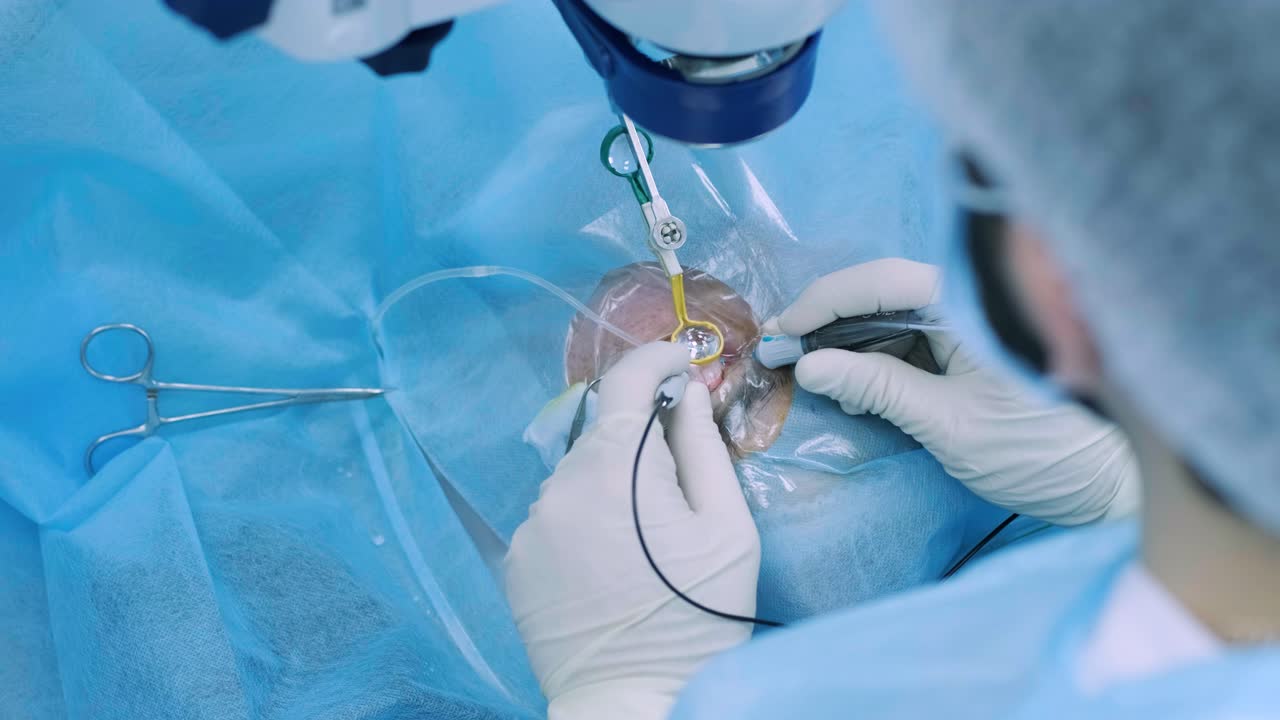 눈 수술, 유리 망막 수술, 비트렉토미 수술