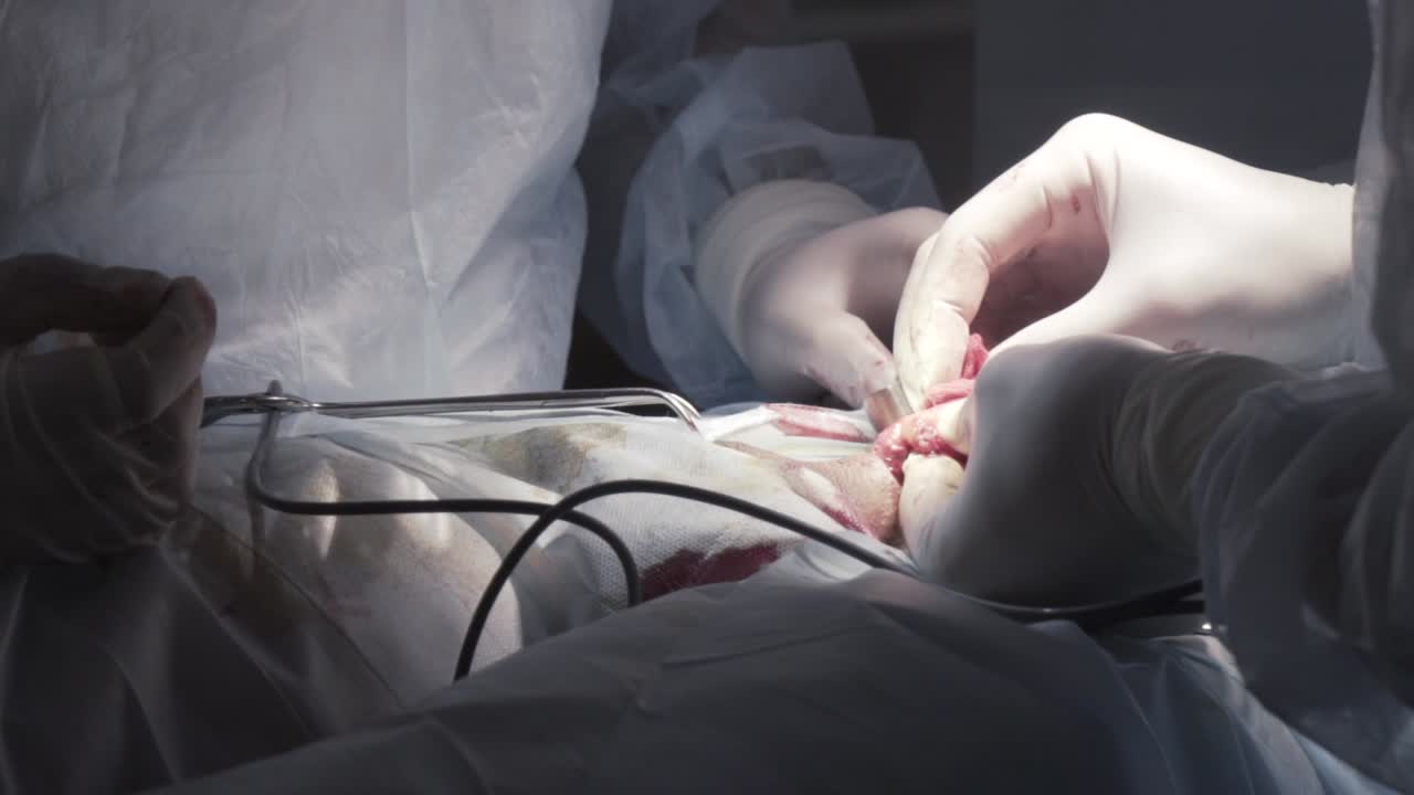 procedimiento quirúrgico