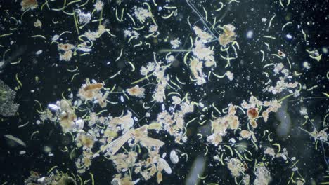 diferentes especies de agua dulce de protozoos organismos unicelulares como estentores, ciliados y movimiento de algas bajo el microscopio vista de campo oscuro