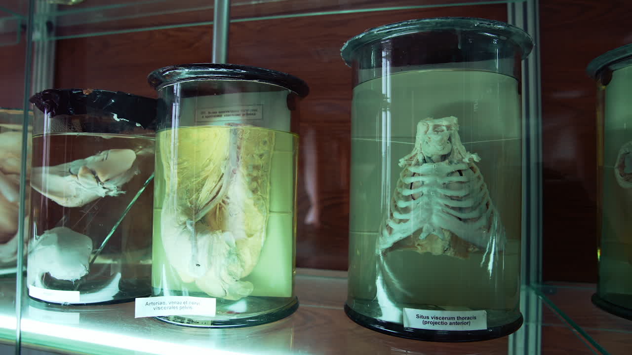 Internal organs of human in medical museum. Anatomical organs in glass tubes with formaldehyde.