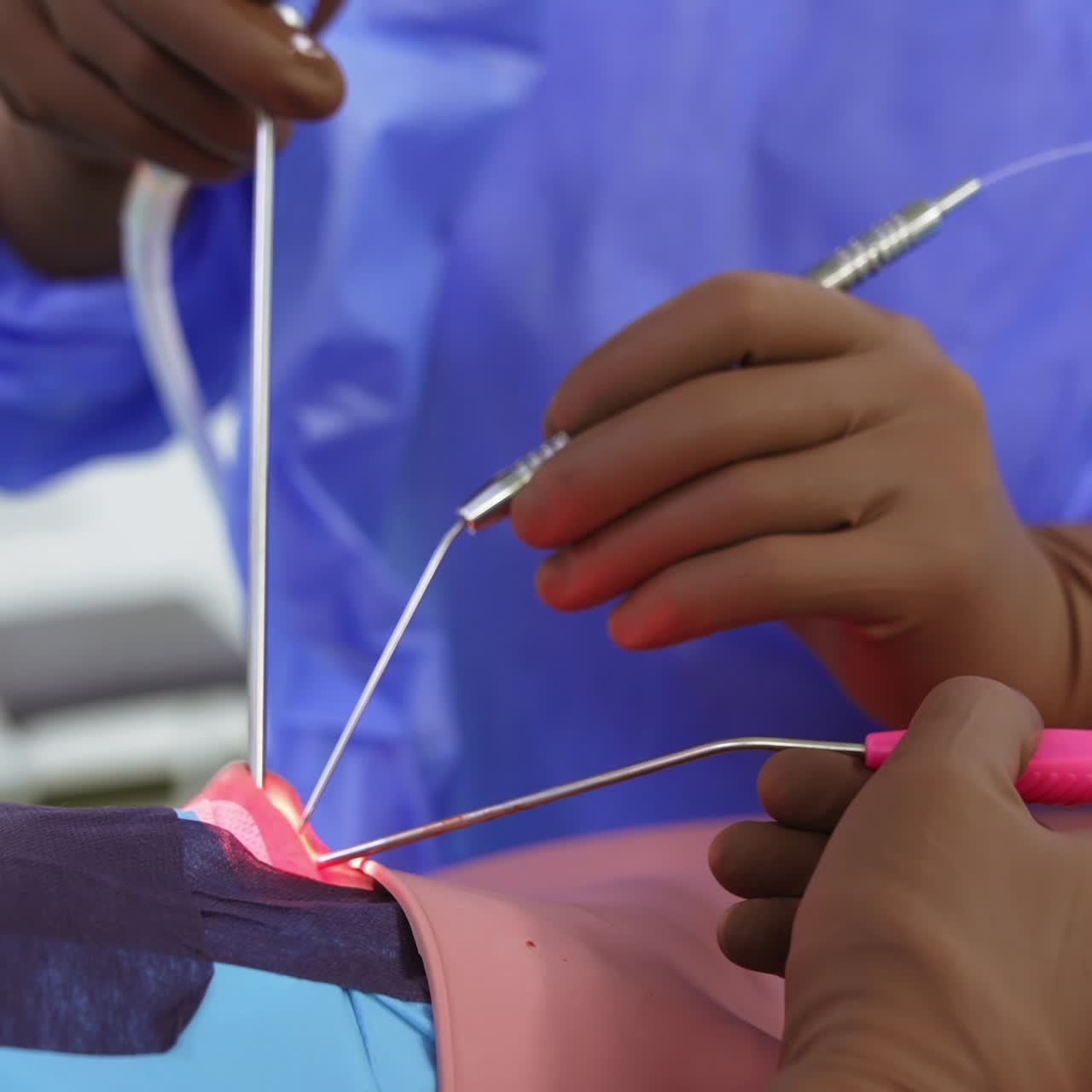 Otolaryngology nasal operation in action. Surgeons team insert special tools into patient's nose. Close up. Blurred backdrop