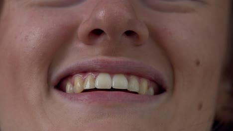 Close-up-view-of-a-woman's-mouth-and-teeth-as-she-smiles