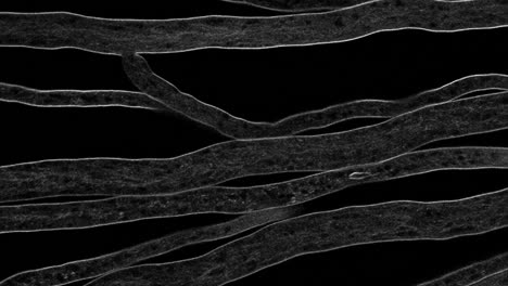 Hyphae-growing-like-a-network-of-arteries