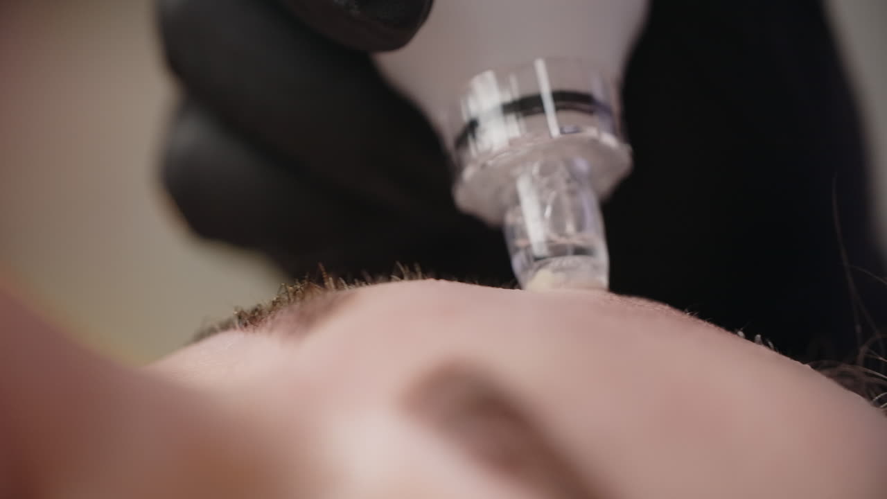 procedimiento de tratamiento facial