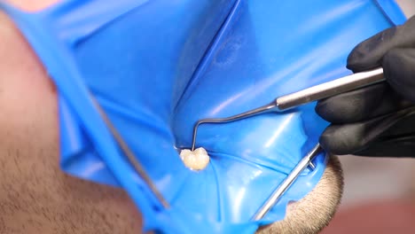 procedimiento dental