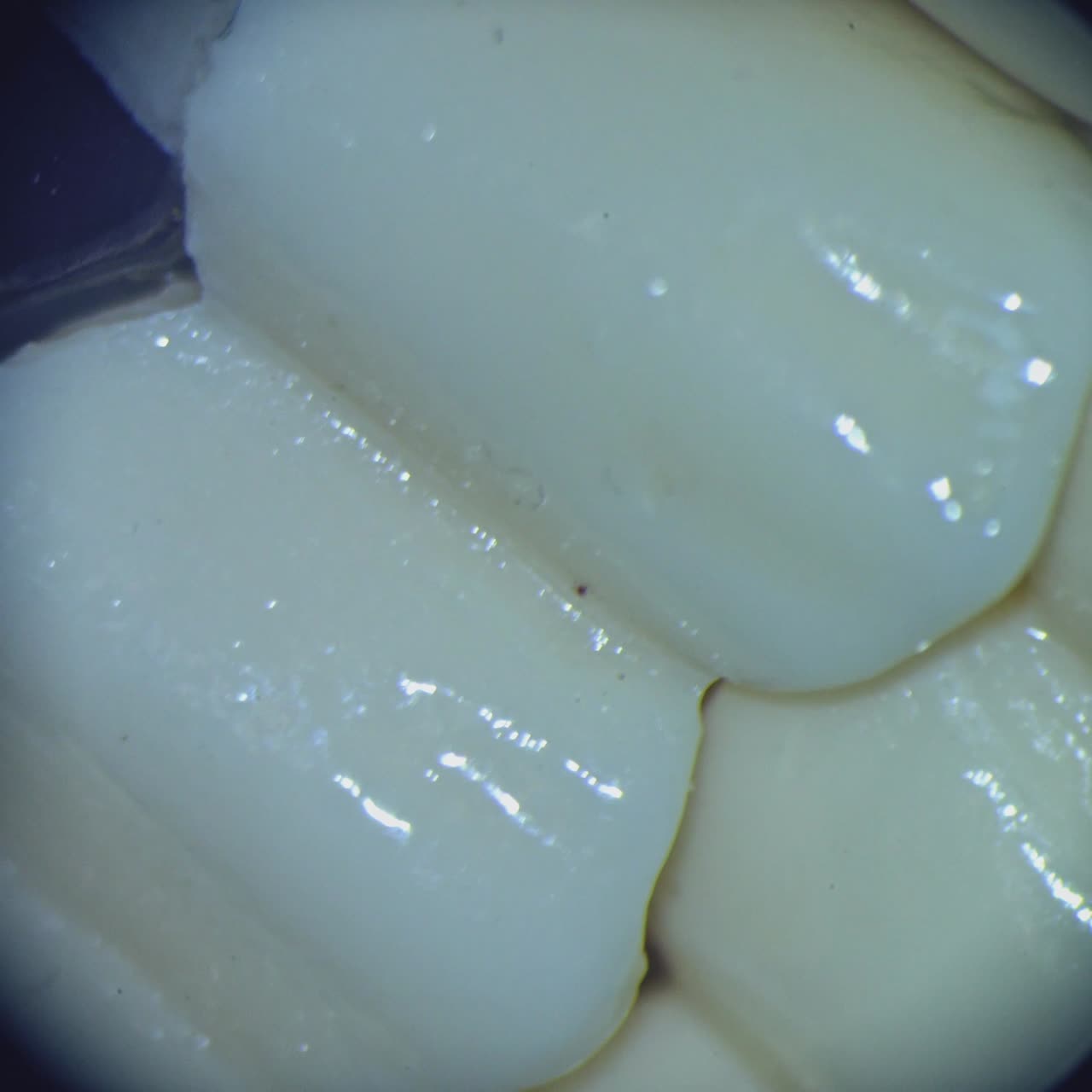 Teeth under the microscope. View from microscope on problem parts of every tooth. Close-up.