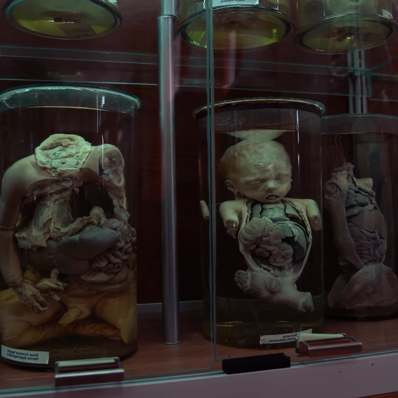 Human in formalin in medical museum. Collection of human organs preserved in large jars with formaldehyde and displayed vertically in museum