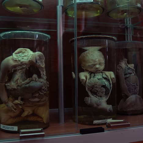 human in formalin in medical museum. collection of human organs preserved in large jars with formaldehyde and displayed vertically in museum