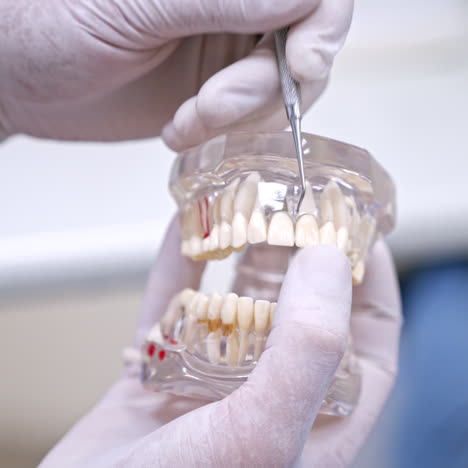 hands holding a jaw model. artificial teeth in stomatologist's hands. dental implant laboratory. progress of dental implantology. close-up.