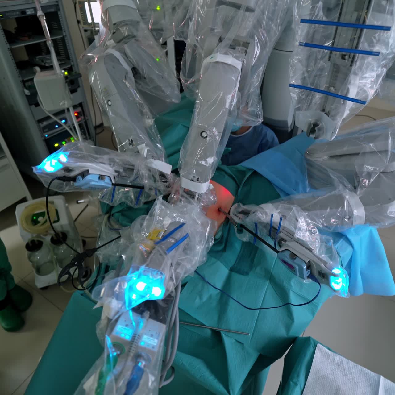Automated robotic surgery. Surgical room in hospital with robotic technology equipment. Machine arms of medical robot doing minimally invasive surgery.Top view.