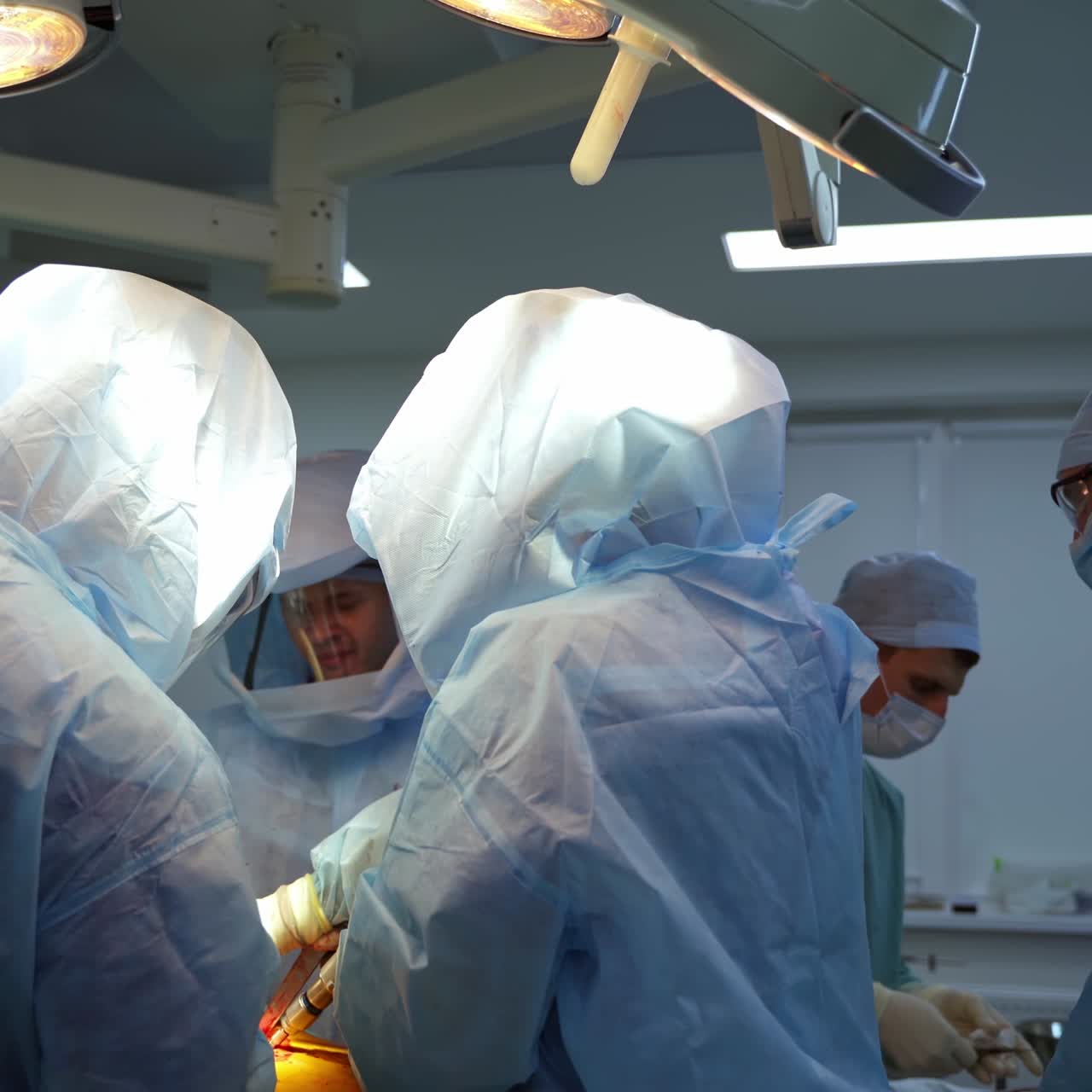 Surgery by group of specialists. Team of professional surgeons in safety suits conduct an operation. Surgical process in intensive care unit.