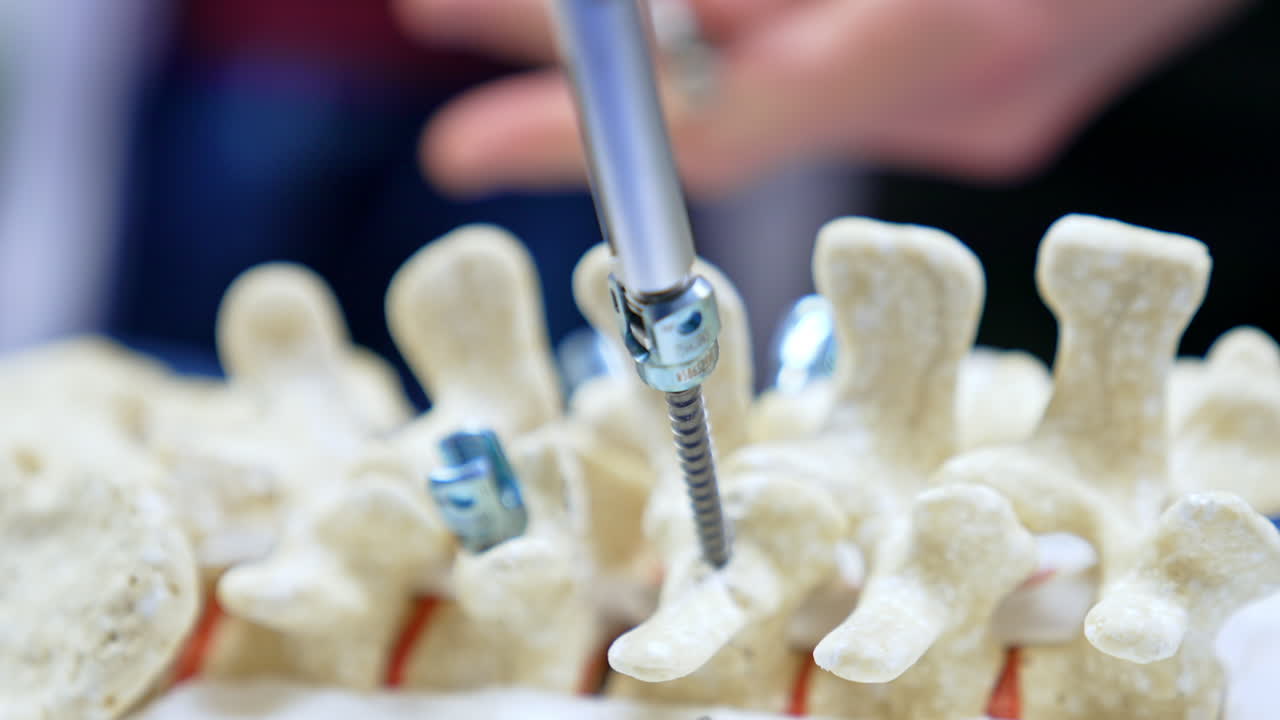 Metal screw is drawn out of a spine mock-up. Teaching future neurosurgeons to practice on a dummy. Close up.