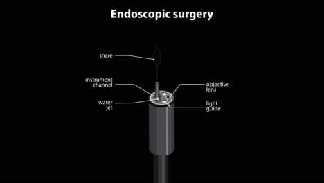 animated sequence illustrating endoscopic surgery in colon, showing instrument insertion, internal view, and anatomy