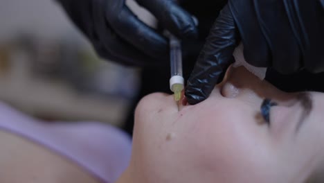 cosmetic injection procedure on a person's face