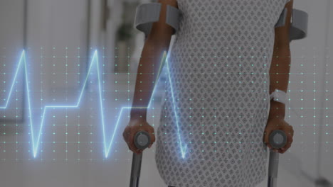 animación de cardiógrafo sobre un niño afroamericano que usa muletas en el hospital
