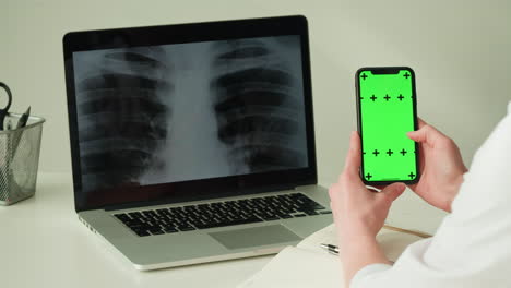 doctor reviewing chest x-ray on laptop and smartphone