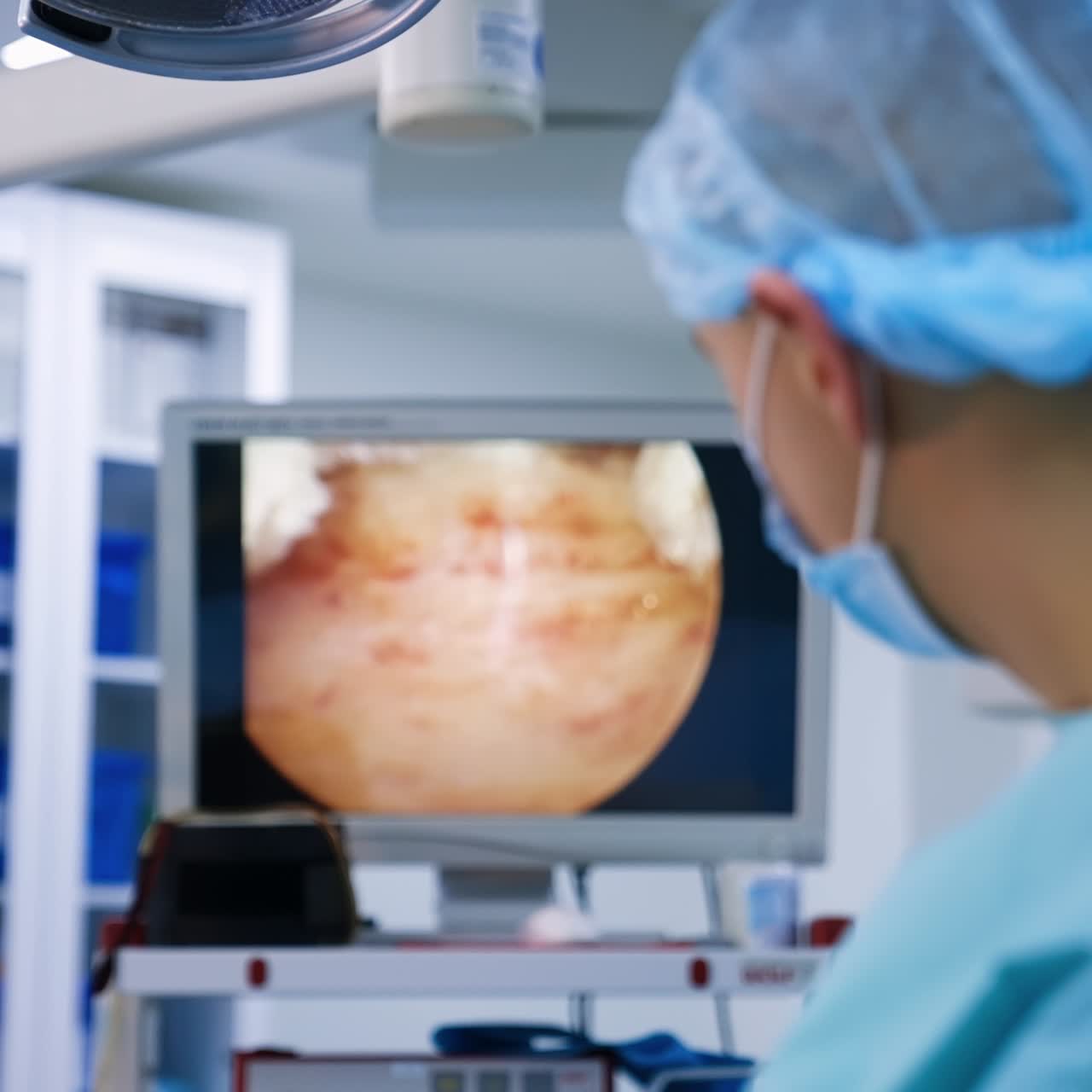 Screen in the operational room showing the operational process. Doctors look at the monitor performing surgery