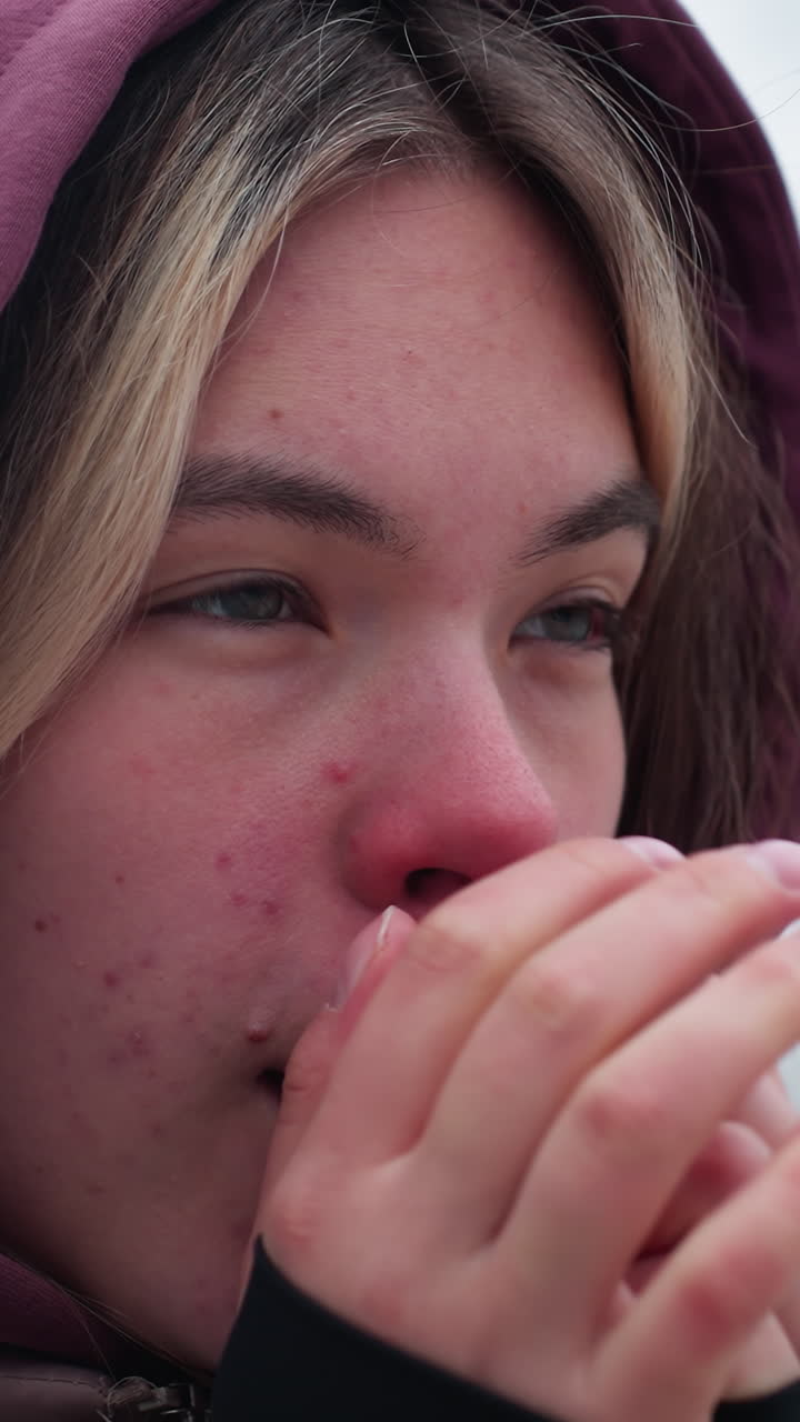 얼굴에 얼룩이 있는 소녀의 클로즈업, 추운 날씨에 서서 코를 고 뜨거운 공기를 손에 어서 따뜻하게 지내며, 후드 인 겨울 옷은 냉정한 날씨를 강조합니다.