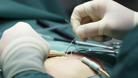 a surgeon skillfully operates on a patient in a sterile environment, showcasing precision during a complex surgical procedure. the focus is on the careful techniques and instruments used.