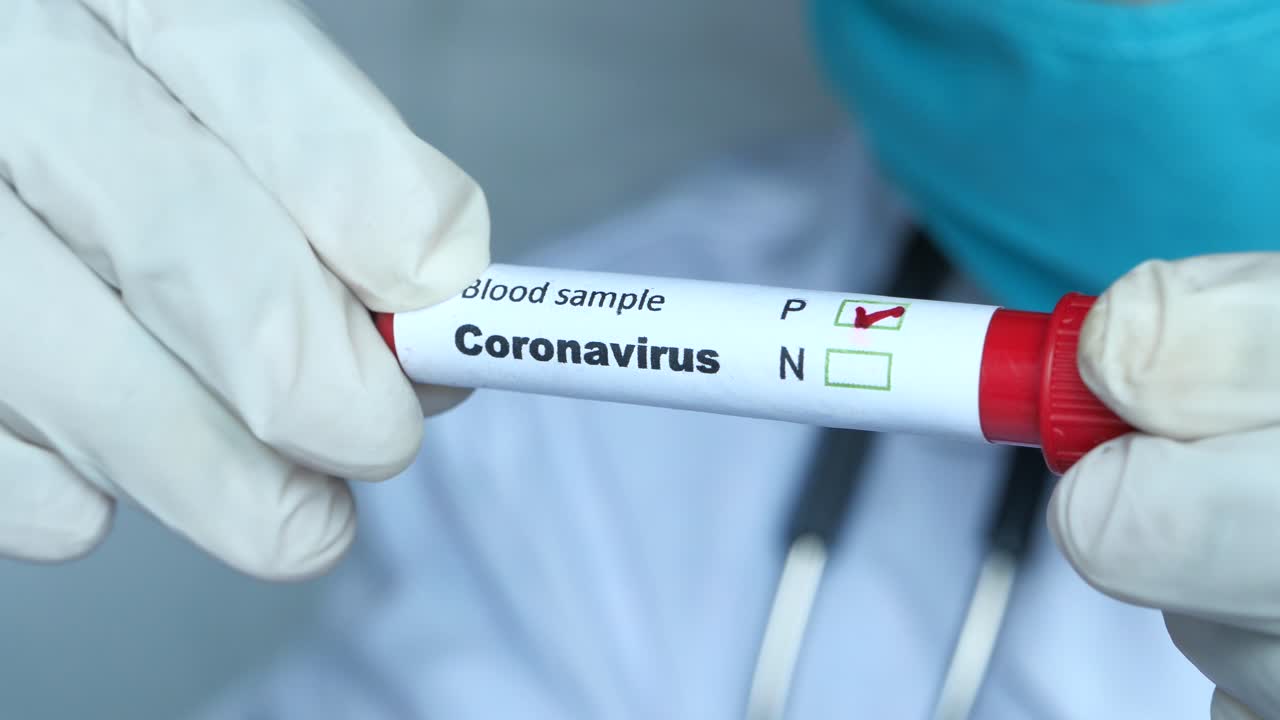 Coronavirus blodprøve