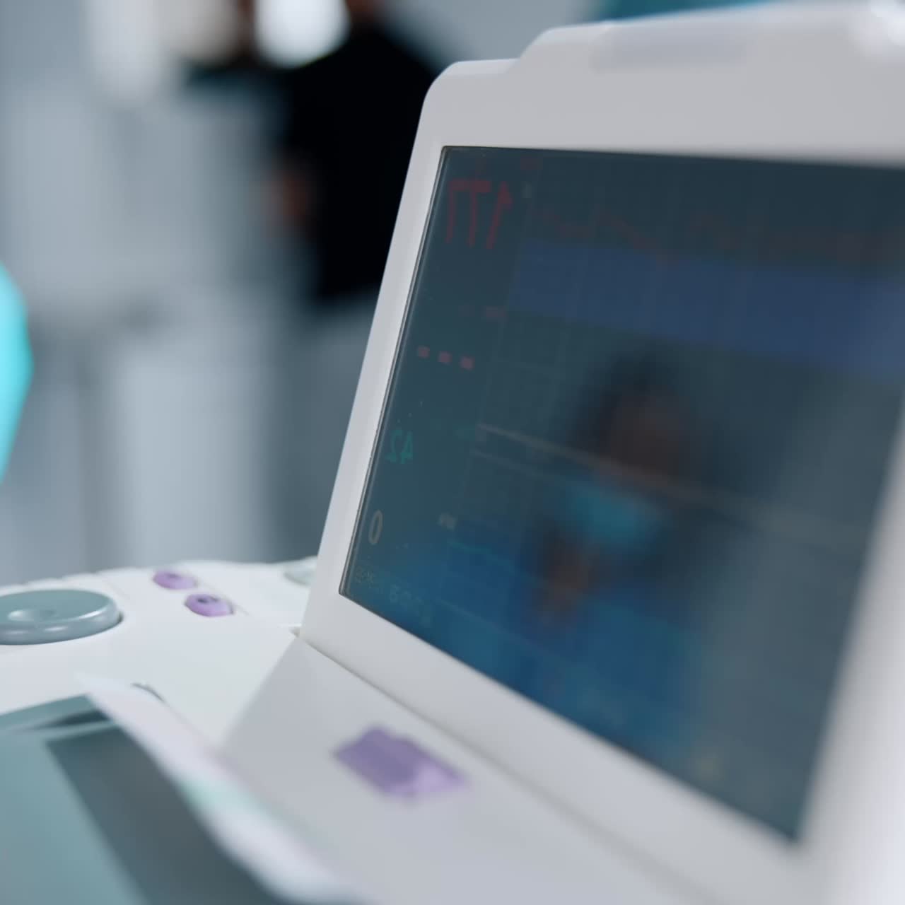 Blurred screen of a electrocardiograph close up. Equipment for fetal heart rate check up in labor room