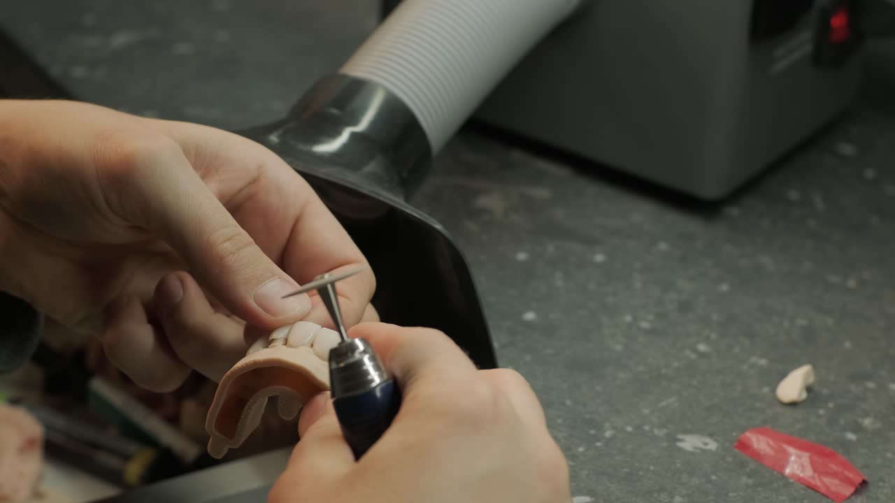 técnico dental pulido de coronas de zirconia molidas con cnc