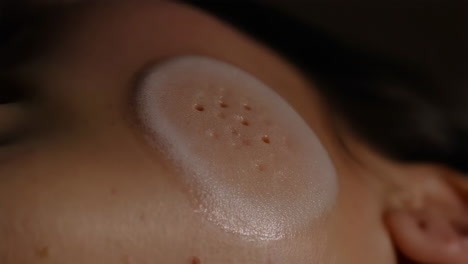 face patch