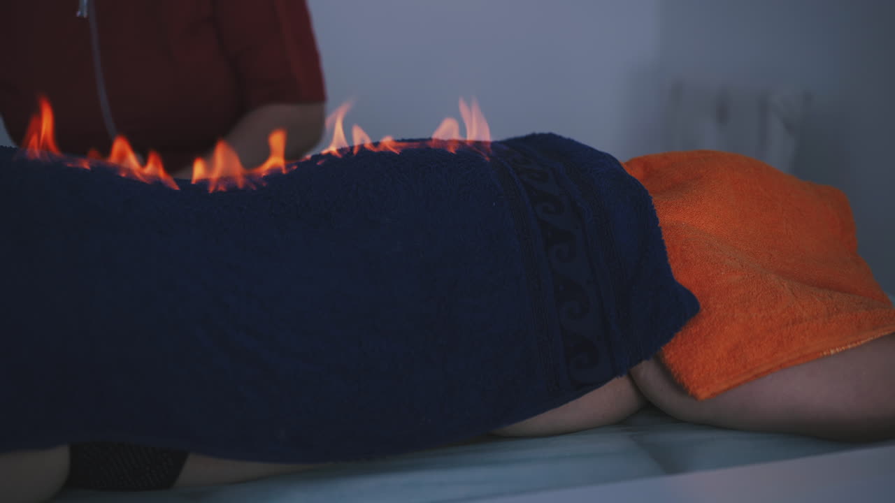 врач распыляет алкоголь на спину пациента с горящим полотенцем