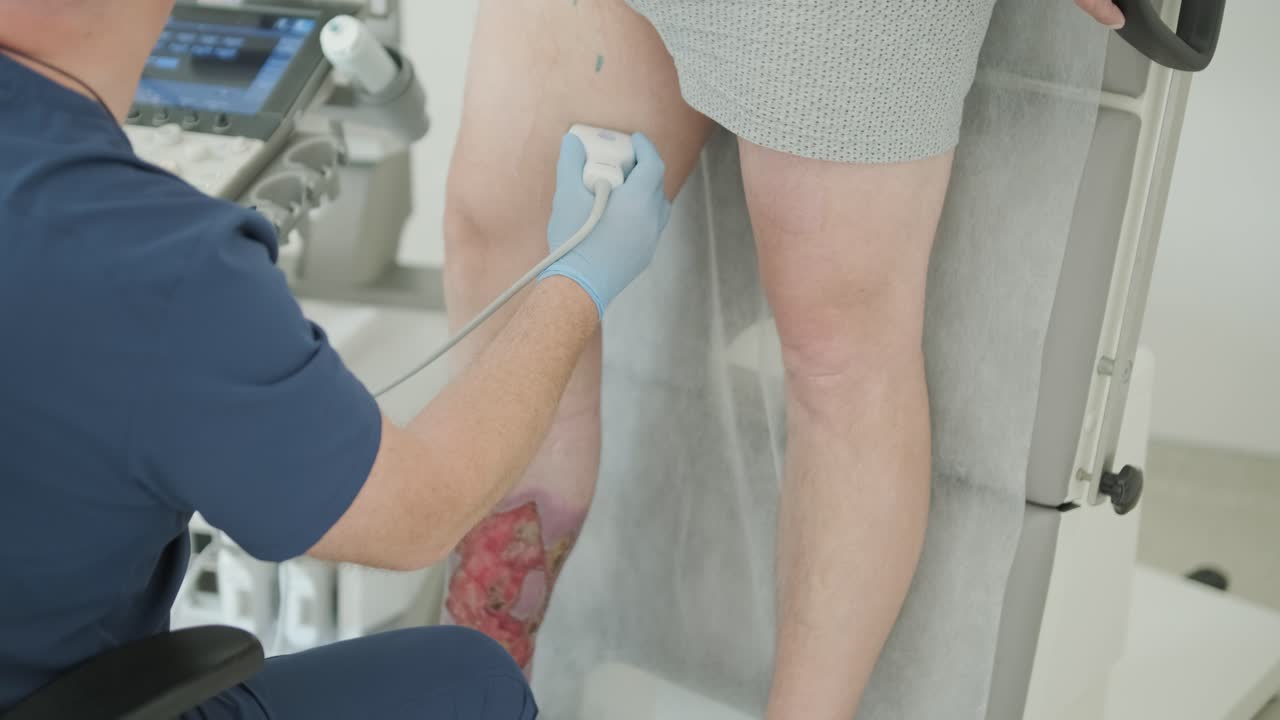 Esame ecografico medico su paziente con ulcera alla gamba