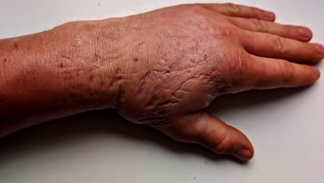 a detailed closeup of a human hand showing many visible cut scars and healed injuries, illustrating skin texture and recovery under natural lighting